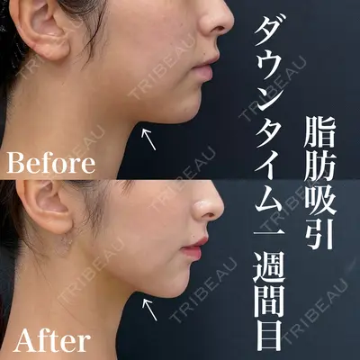 湘南美容クリニック 渋谷院 小草 智之医師の症例