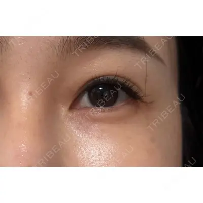 しんゆり美容健康クリニックの症例