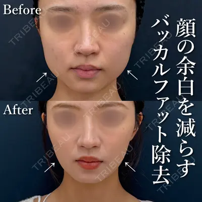 湘南美容クリニック 渋谷院 小草 智之医師の症例
