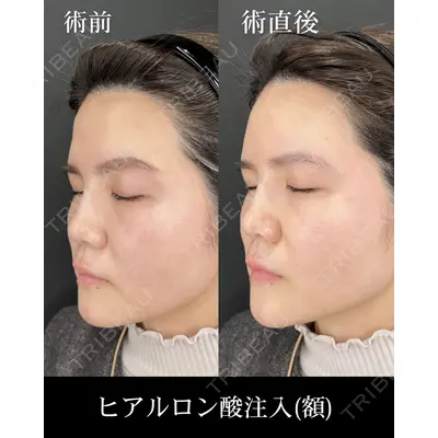 HAAB×DREAM BEAUTY CLINIC 大阪梅田院 柏木 太雅医師の症例