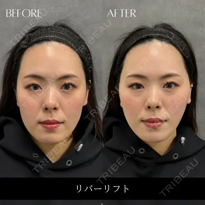 RIVER CLINIC（リバークリニック）大阪院の症例
