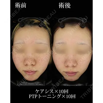 HAAB×DREAM BEAUTY CLINIC 大阪梅田院の症例