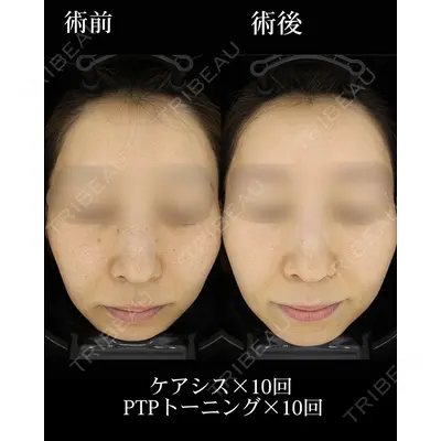 HAAB×DREAM BEAUTY CLINIC 大阪梅田院の症例