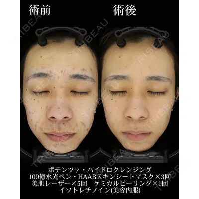 HAAB×DREAM BEAUTY CLINIC 東京本院の症例