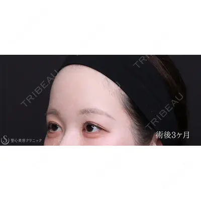 聖心美容クリニック 銀座院 川端 優也医師の症例