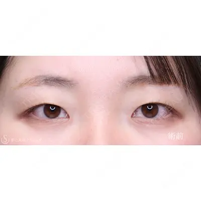 聖心美容クリニック 銀座院 川端 優也医師の症例
