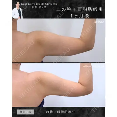 Next Tokyo Clinic 松本 俊太郎医師の症例