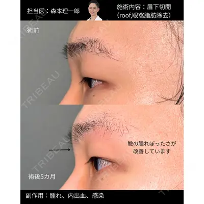 PRISM Beauty Clinic 新宿院の症例