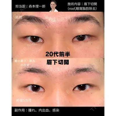 PRISM Beauty Clinic 新宿院の症例