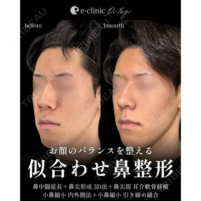 eクリニック 大阪院 八木 良太医師の症例