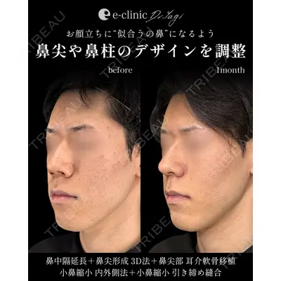 eクリニック 大阪院 八木 良太医師の症例