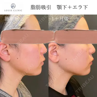 LOUIS CLINIC 二子玉川院【ルイクリニック】 小松 塁医師の症例