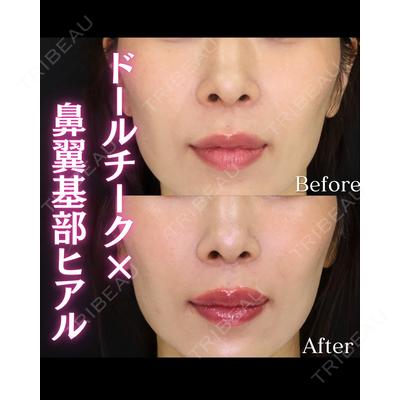 KIMI CLINIC 形成・美容外科 志藤 宏計医師の症例
