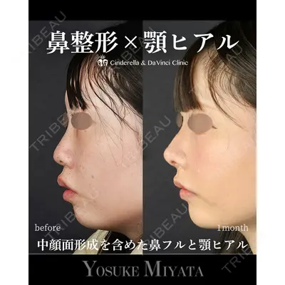 シンデレラ＆ダヴィンチクリニック 宮田 洋佑医師の症例
