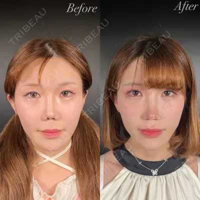 R Beauty CLINIC 銀座院 吉田　慧医師の症例