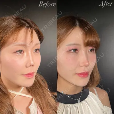R Beauty CLINIC 銀座院 吉田　慧医師の症例