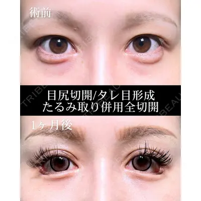 HAAB×DREAM BEAUTY CLINIC 大阪梅田院 鈴木 馨斗医師の症例