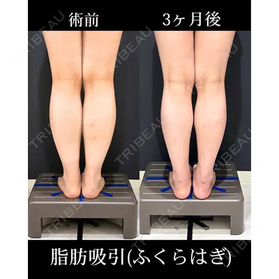 HAAB×DREAM BEAUTY CLINIC 東京本院 吉岡 修一医師の症例