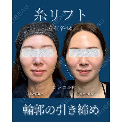 ECLA CLINIC (エクラクリニック)の症例