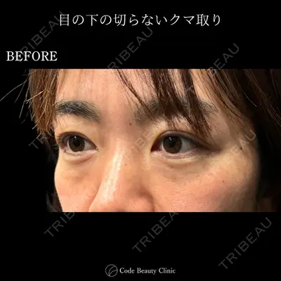 Code Beauty Clinic 名古屋院 橋本 祥平医師の症例