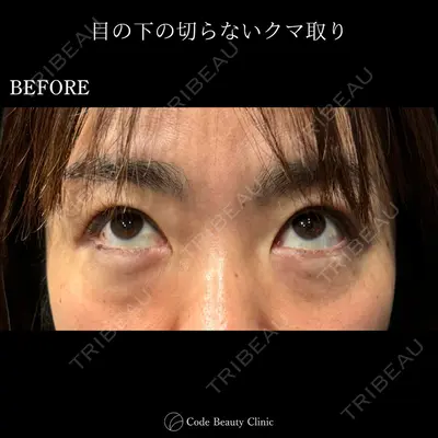 Code Beauty Clinic 名古屋院 橋本 祥平医師の症例