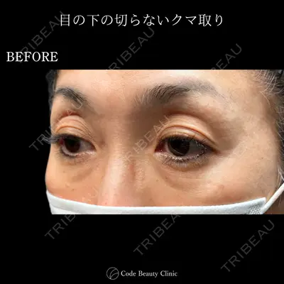 Code Beauty Clinic 名古屋院 橋本 祥平医師の症例