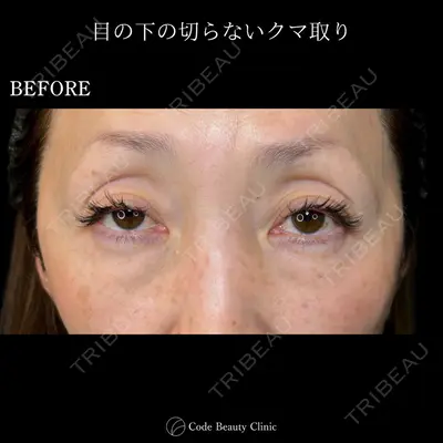 Code Beauty Clinic 名古屋院 橋本 祥平医師の症例