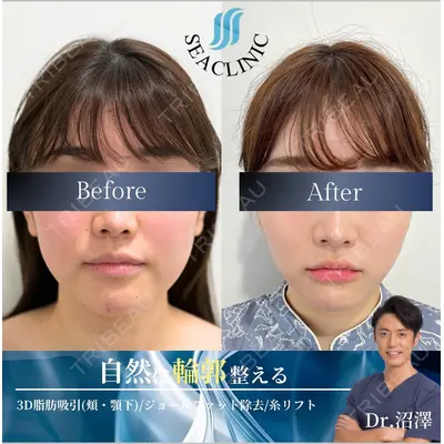 SEA CLINIC（シークリニック） 沼澤 茂医師の症例