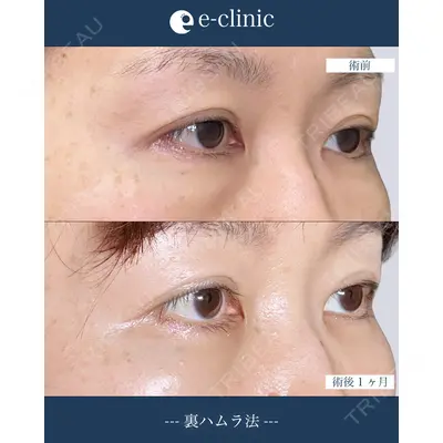eクリニック 横浜みなとみらい院 坂本 優衣医師の症例
