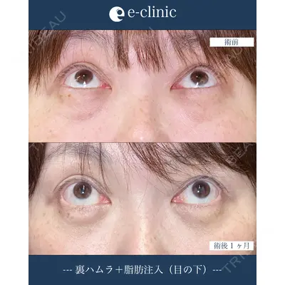 eクリニック 横浜みなとみらい院 坂本 優衣医師の症例
