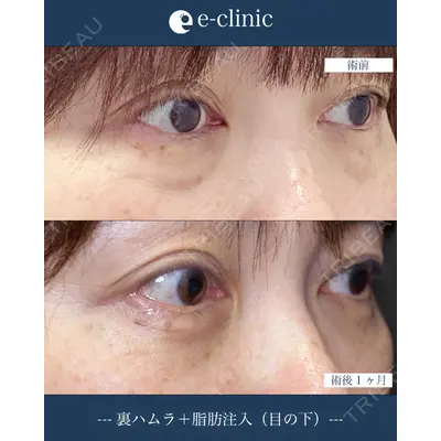 eクリニック 横浜みなとみらい院 坂本 優衣医師の症例