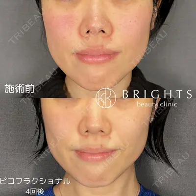 BRIGHTS beauty clinic 今村 直樹医師の症例