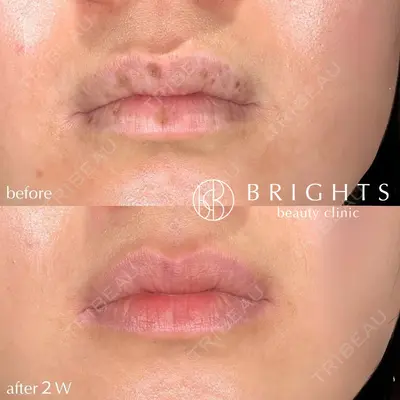 BRIGHTS beauty clinic 今村 直樹医師の症例