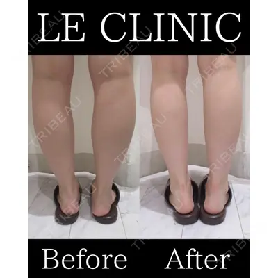 LE CLINICの症例