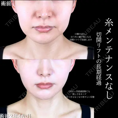 アリエル美容クリニック 大宮院 阪野 一世医師の症例