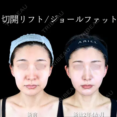 アリエル美容クリニック 大宮院 阪野 一世医師の症例