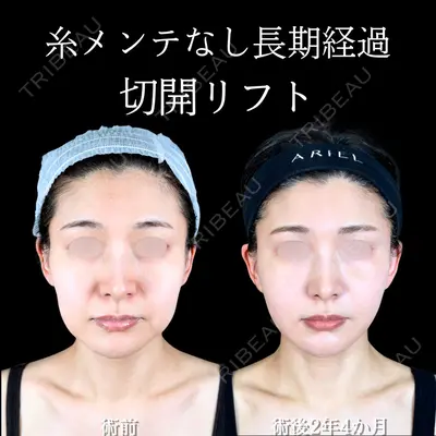 アリエル美容クリニック 大宮院 阪野 一世医師の症例