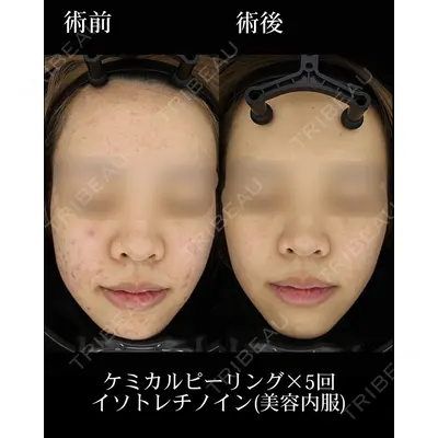 HAAB×DREAM BEAUTY CLINIC 東京本院の症例