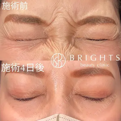 BRIGHTS beauty clinic 今村 直樹医師の症例