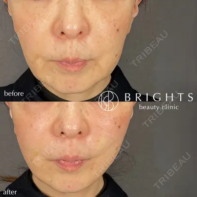 BRIGHTS beauty clinic 今村 直樹医師の症例