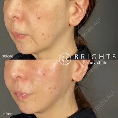 BRIGHTS beauty clinic 今村 直樹医師の症例