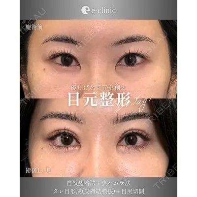 eクリニック 大阪院 八木 良太医師の症例