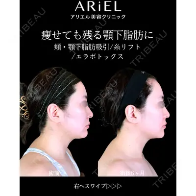 アリエル美容クリニック 郡山院 安齋 誠基医師の症例