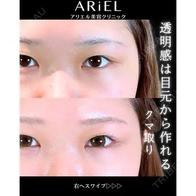 アリエル美容クリニック 郡山院 安齋 誠基医師の症例