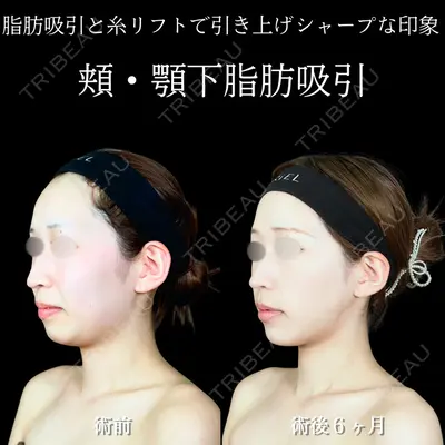 アリエル美容クリニック 横浜院 渡邉 光医師の症例