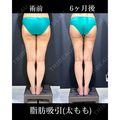HAAB×DREAM BEAUTY CLINIC 東京本院 吉岡 修一医師の症例
