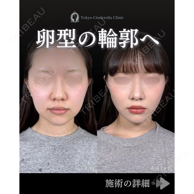 東京シンデレラ美容外科 池袋院 石井 達也医師の症例