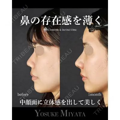 シンデレラ＆ダヴィンチクリニック 宮田 洋佑医師の症例