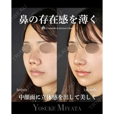 シンデレラ＆ダヴィンチクリニック 宮田 洋佑医師の症例