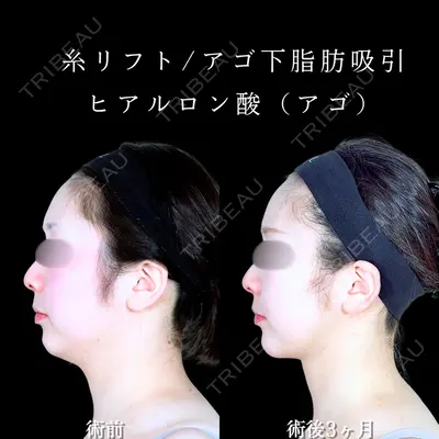 アリエル美容クリニック 水戸院 天白 典秀医師の症例